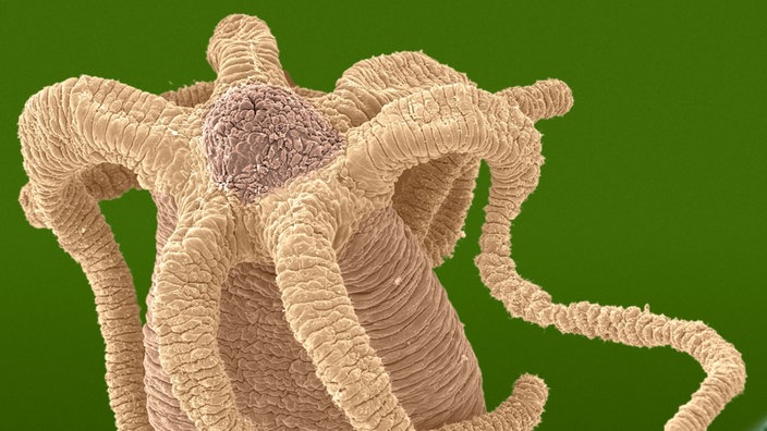 Mikroskopaufnahme des Süßwasserpolypen Hydra. | Bildquelle: Mauritius Mikroskopaufnahme des Süßwasserpolypen Hydra.