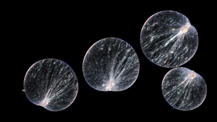 Mikroskopaufnahme des Einzellers Dinoflagellat