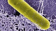Rasterelektronenmikroskopische Falschfarbenaufnahme eines stabförmigen grüngelb eingefärbten Bakteriums (Clostridium botulinum) vor lilafarbenem Hintergrund.