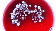 In einer Petrischale mit Nährboden haben sich Bakterien angesiedelt