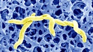 Rasterelektronenmikroskopie von Campylobacter jejuni (2000-fache Vergrößerung)
