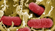 REM-Aufnahme: Enterohämorrhagische Escherichia Coli (EHEC)