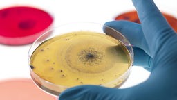 Ein Forscher hält eine Petrischale, auf der sich Bakterienkolonien angesiedelt haben (dunkle Flecken)