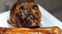 Kopf, Arm und ein Teil des Oberkörpers von Ötzi.