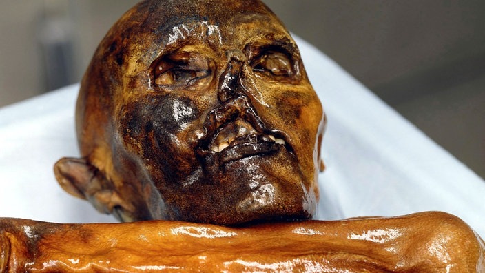 Kopf, Arm und ein Teil des Oberkörpers von Ötzi. | Bildquelle: WDR/dpa Kopf, Arm und ein Teil des Oberkörpers von Ötzi.