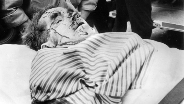 Schwarzweiß-Foto: Ein Verletzter wird auf einer Trage vom Gebäude des Axel-Springer-Verlages abtransportiert. Seine Augen sind geschlossen, sein Kopf ist mit Blut verschmiert.