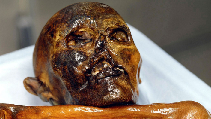 Nahaufnahme des Kopfes des Similaun-Mannes: Die 5300 Jahre alte gefrorene Mumie "Ötzi"