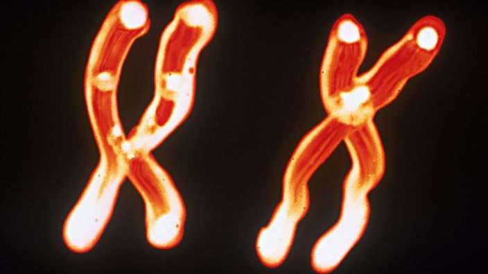 Grafische Darstellung eines X-Chromosoms.