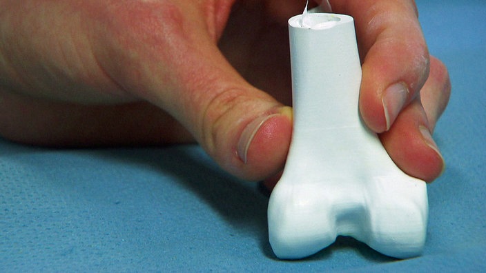 3-D-Druck in der Medizintechnik