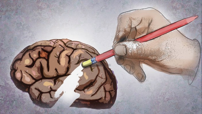 Zeichnung: Eine Hand radiert einen Teil des Gehirns aus