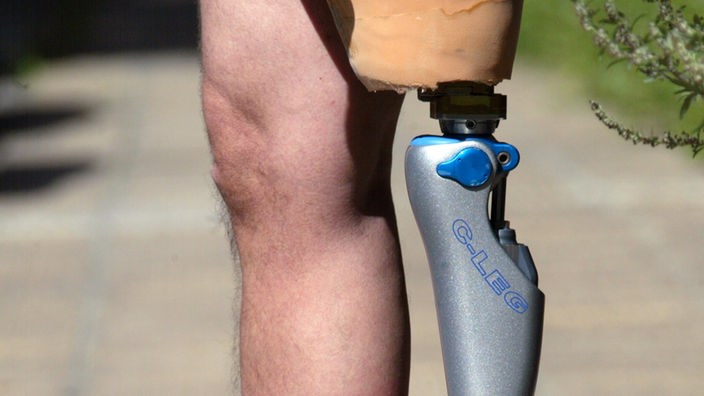 Ein Mann trägt eine Beinprothese.