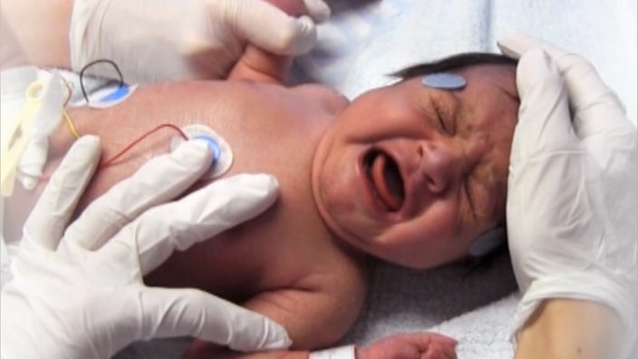 Ein schreinenes Neugeborenes, mit EKG-Sensoren auf der Brust, wird von Händen in Plastikhandschuhen berührt.