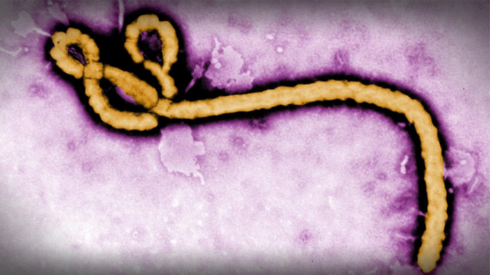 Vergrößerung Ebolavirus