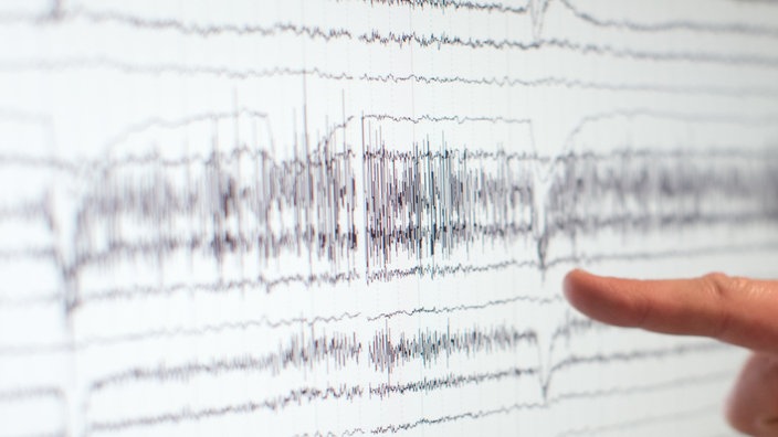 Eine Hand zeigt auf einen Kontrollmonitor, der die Gehirnströme von einem Epilepsie-Patienten anzeigt | Bildquelle: dpa/Friso Gentsch Eine Hand zeigt auf einen Kontrollmonitor, der die Gehirnströme von einem Epilepsie-Patienten anzeigt