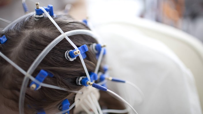 An einem Kopf sind mehrere Elektroden befestigt, die der Elektroenzephalografie (EEG) dienen