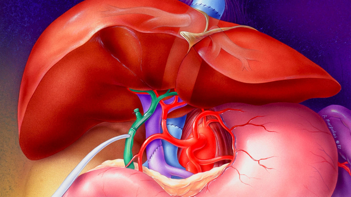 Grafik einer Leber, mit Venen und der Arterie.
