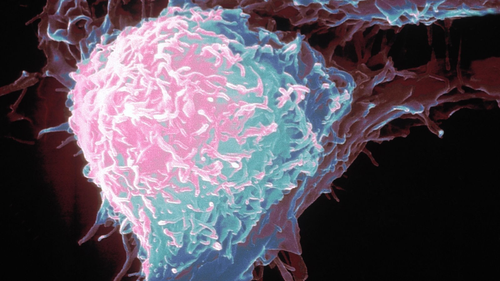 Krankheiten: Krebs - Krankheiten - Gesellschaft - Planet Wissen