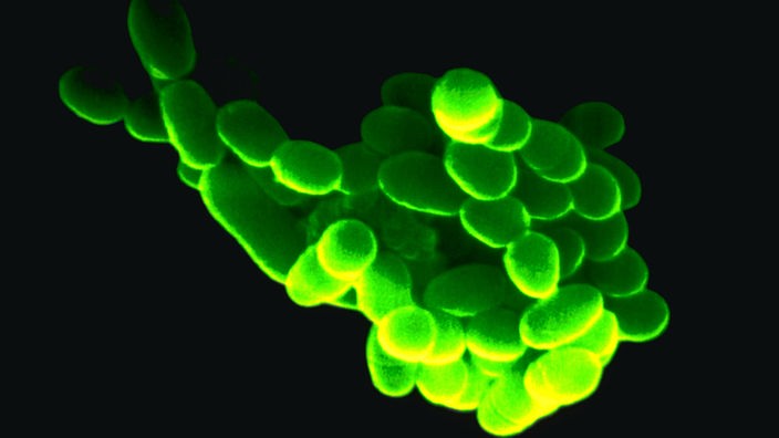 Unter dem Mikroskop leuchten die Milchsäurebakterien grell grün.