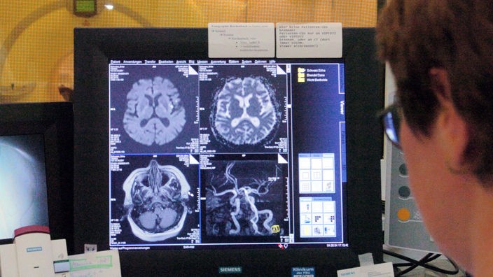 Ein Wissenschaftler betrachtet auf einem Monitor die Computertomographie eines Kopfes.
