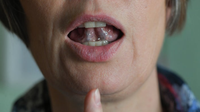 Mund formt ein "L", Zeigefinger zeigt auf Mund