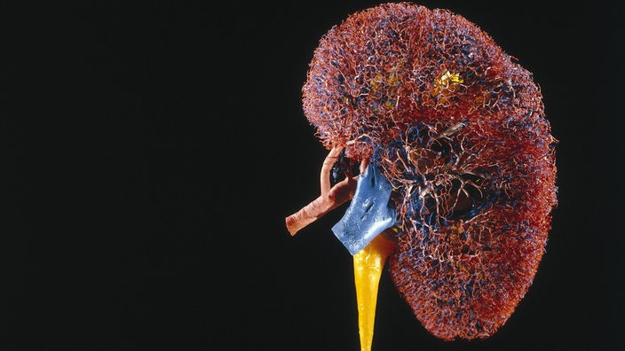Modell des Gefäßsystems einer menschlichen Niere