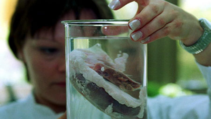 Menschliches Organ in Laborglas.