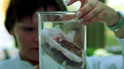 Menschliches Organ in Laborglas. | Bildquelle: ddp Menschliches Organ in Laborglas.