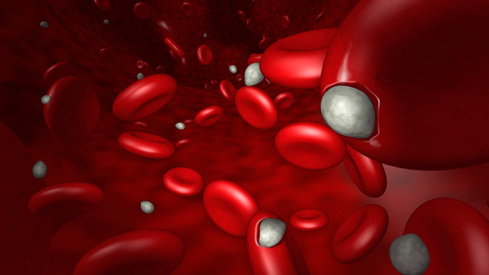 Eine Illustration zeigt, wie Malaria-Erreger (hier als graue Kugeln dargestellt) in rote Blutkörperchen eindringen.
