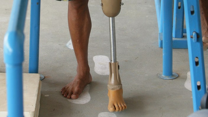 Mann läuft mit Prothese aus Kunststoff.