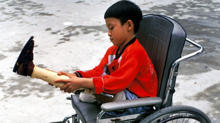 Junge im Rollstuhl zieht eine Prothese an.