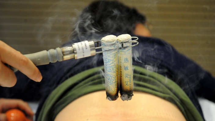 Eine Moxibustion-Behandlung