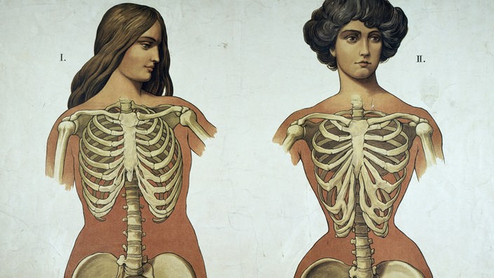 Zeichnung: Eine Frau mit normalem Brustkorb, eine Frau mit verengtem Brustkorb
