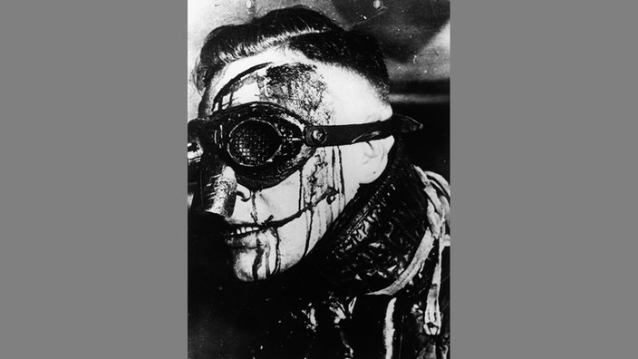 Archivbild: Verbindungsstudent nach dem Fechtkampf mit Gesichtsmaske und Verletzungen. | Bildquelle: akg Archivbild: Verbindungsstudent nach dem Fechtkampf mit Gesichtsmaske und Verletzungen.