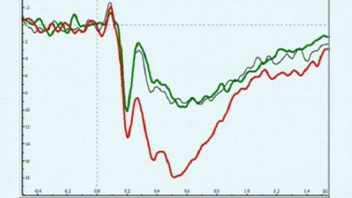 Die Grafik zeigt ein Diagramm mit einer stark ausschlagenden roten und einer gemäßigt ausschlagenden grünen Kurve.