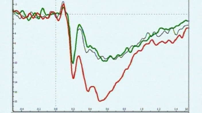 Die Grafik zeigt ein Diagramm mit einer stark ausschlagenden roten und einer gemäßigt ausschlagenden grünen Kurve. | Bildquelle: wdr Die Grafik zeigt ein Diagramm mit einer stark ausschlagenden roten und einer gemäßigt ausschlagenden grünen Kurve.