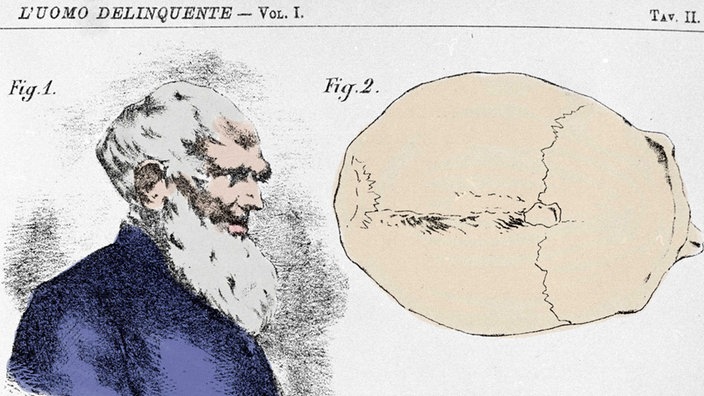 Grafik: Schädelform eines Verbrechers, wie sie sich der Gefängnisarzt Cesare Lombroso im 19. Jahrhundert vorstellte.