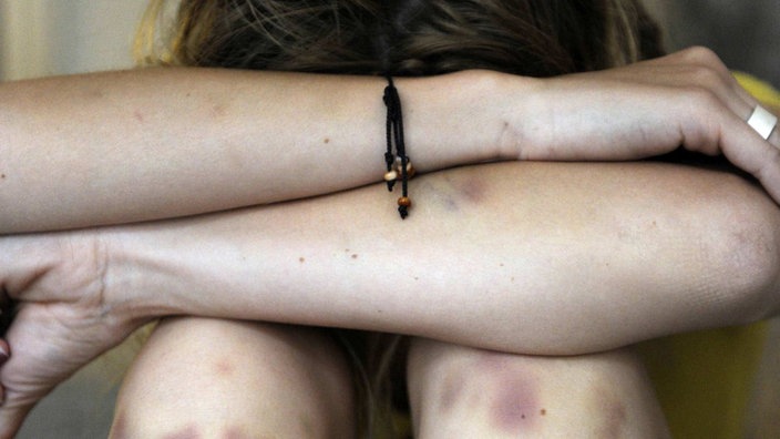 Eine junge Frau hockt am Boden, die Arme über den Knien verschränkt, mit blauen Flecken an den Beinen. | Bildquelle: WDR/Imago Stock&People/Felix Jason Eine junge Frau hockt am Boden, die Arme über den Knien verschränkt, mit blauen Flecken an den Beinen.