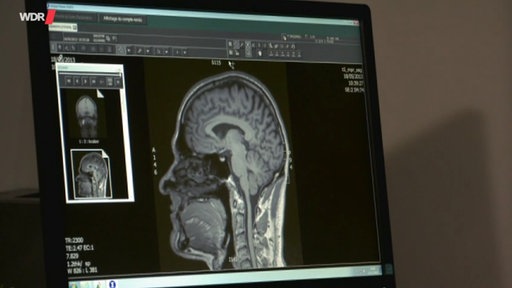 Screenshots aus dem Film "Wie funktioniert Hypnose?"