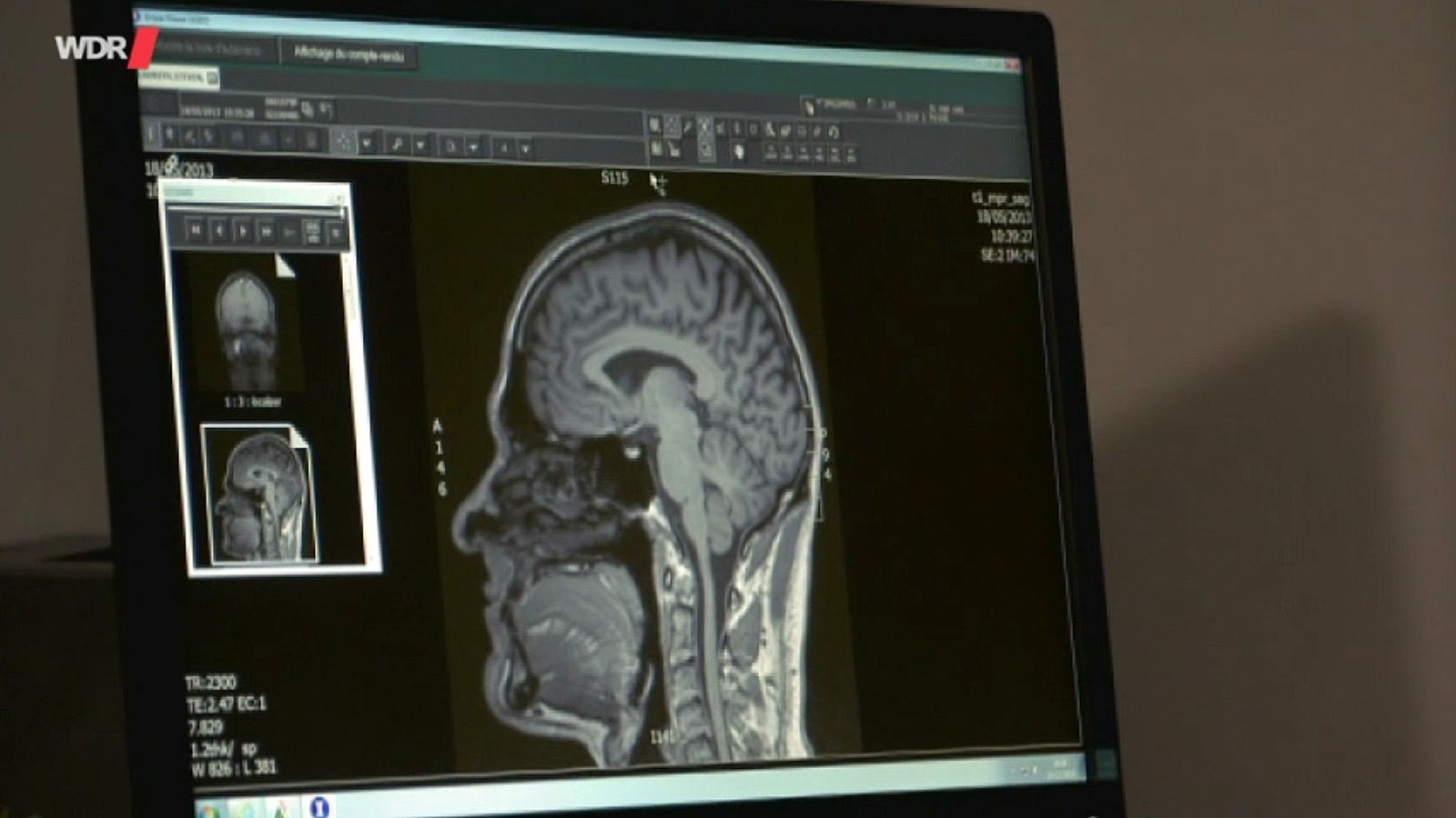 Screenshots aus dem Film "Wie funktioniert Hypnose?"