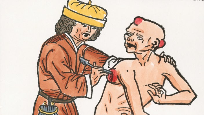 Zeichnung: Ein Pestarzt schneidet einem fast nackten Patienten Beulen auf