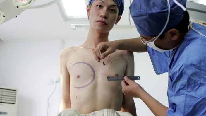 Operation zur Geschlechtsangleichung in China.
