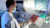 Ein Mitarbeiter der Kriminaltechnik untersucht verschiedene Speichelproben.