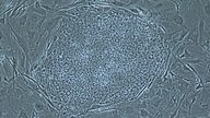Geklont: eine embryonale Stammzelle unterm Mikroskop.