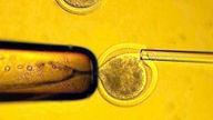 Eine Nadel injiziert eine Körperzelle in eine Eizelle.