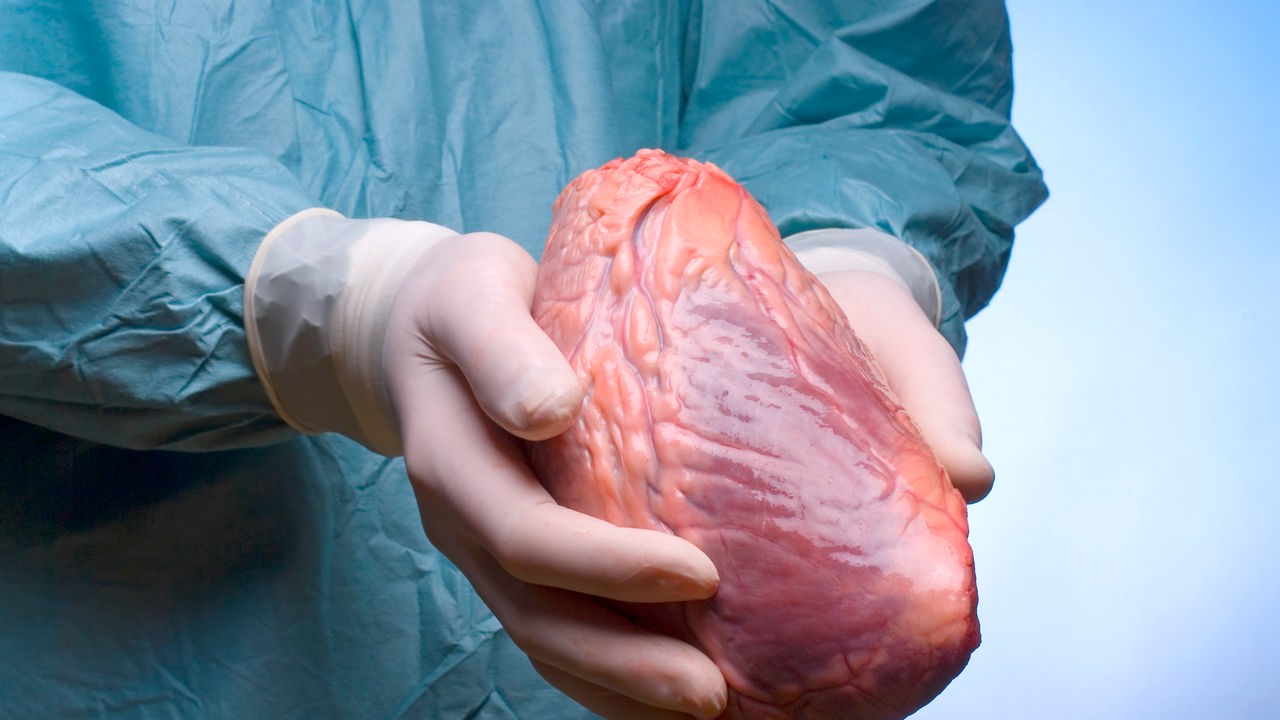Ein Chirurg hält ein menschliches Herz in Händen