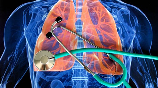 Ein türkises Stethoskop liegt auf einer Grafik einer Lunge.