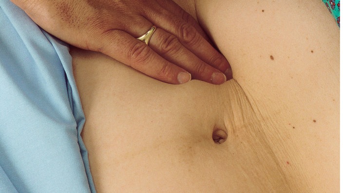 Ein Arzt tastet eine Patientin ab | Bildquelle: Phototake Ein Arzt tastet eine Patientin ab