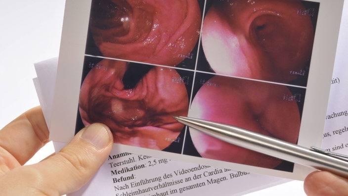 Ein Arzt hält die Befunde einer Magenspiegelung in den Händen | Bildquelle: imago stock&people Ein Arzt hält die Befunde einer Magenspiegelung in den Händen