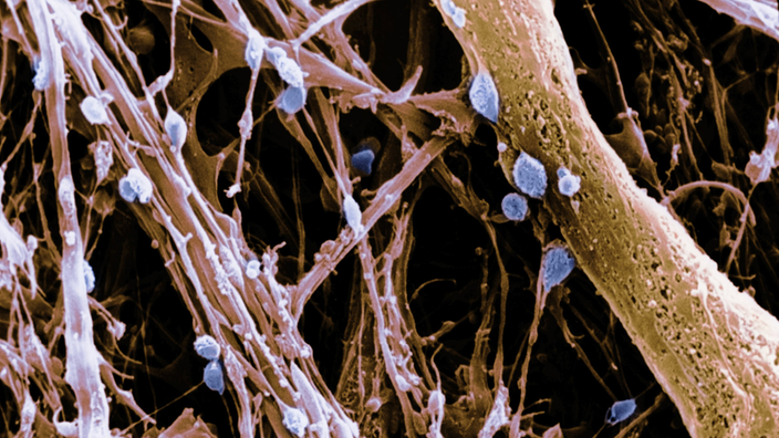 Elektronenmikroskopaufnahme des Hypothalamus mit Parenchymen und Neuronen | Bildquelle: Mauritius Elektronenmikroskopaufnahme des Hypothalamus mit Parenchymen und Neuronen