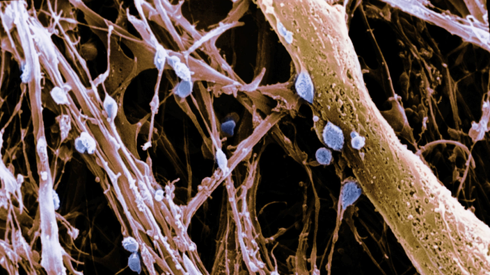 Elektronenmikroskopaufnahme des Hypothalamus mit Parenchymen und Neuronen | Bildquelle: Mauritius Elektronenmikroskopaufnahme des Hypothalamus mit Parenchymen und Neuronen